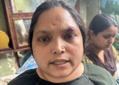 लखनऊ में महिला पर जानलेवा हमला, शिकायत करने पर जान से मारने और झूठे केस में फंसाने की धमकी